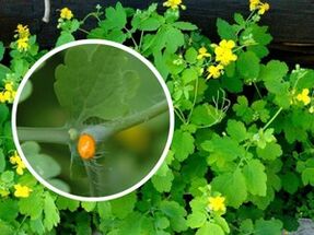 Succo di erbe di celidonia per il trattamento delle verruche plantari